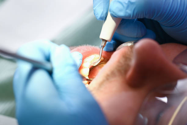 Best Urgent Tooth Repair  in Auburn, NE